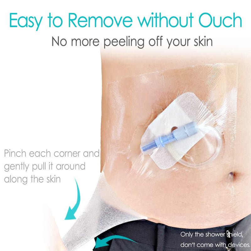 Peritoneal Dialysis Shower Protector Shields, Waterproof Dialysis Port Cover for PD Chest Catheter Peg Feeding Tube G-Tube Picc Line Post Surgery Patient Bathing 7.9"x7.9"(Pack of 25) 8x8 Inch (Pack of 25)