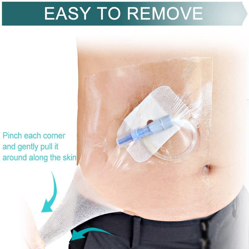 Waterproof PICC line Shower Cover Shield Protector Peritoneal Dialysis Accessories Large Coverage for Central Line PD Catheter Feeding G Peg Tube Chest Port Transfer Set Men Women (9"x 9",Pack of 25) (9"x 9",pack of 25)