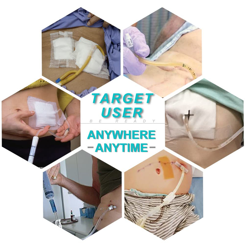 PD Belt Peritoneal Dialysis Catheter Holder Accessories No-Bounce for Secure Transfer Set Peg G Feeding Tube Line Adults Women Men Beige
