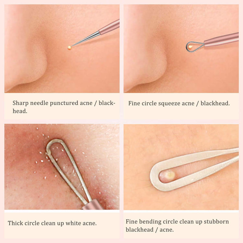 BESTOPE Blackhead Remover Pimple Comedone Extractor Tool Best Acne Removal Kit - Treatment for Blemish, Whitehead Popping, Zit Removing for Risk Free Nose Face Skin With Metal Case(Rose Gold) Rose Gold