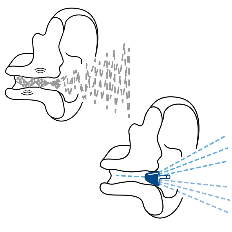 Flare Audio® Calmer® PRO Mini – in Ear Device to Gently Soothe Sound sensitivities and Reduce Stress - for Sensitive Hearing, Autism, ADHD