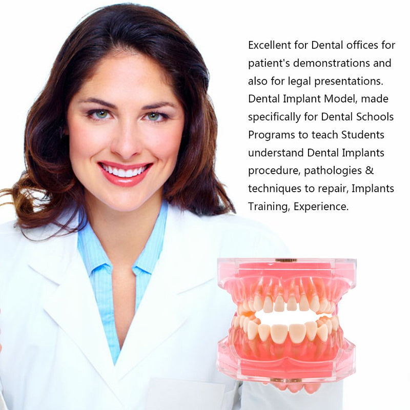 Angzhili Dental Removable Teeth Model Silica Gel Material Soft and Bendable Tooth Model Ideal Dental Lab Materials Teaching Tool Flesh Pink (1 Piece)