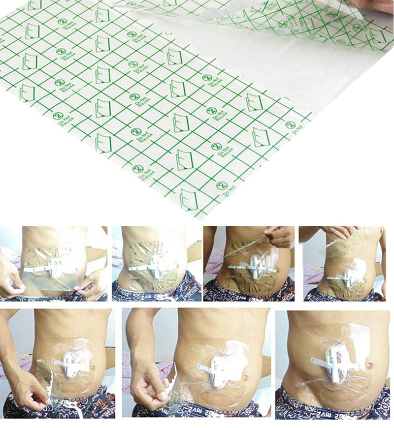 Mediss Peritoneal Dialysis Catheter Shower Cover - Transparent Film Wound Dressing Shields Barrier,8 inches x8 inches , 50pcs