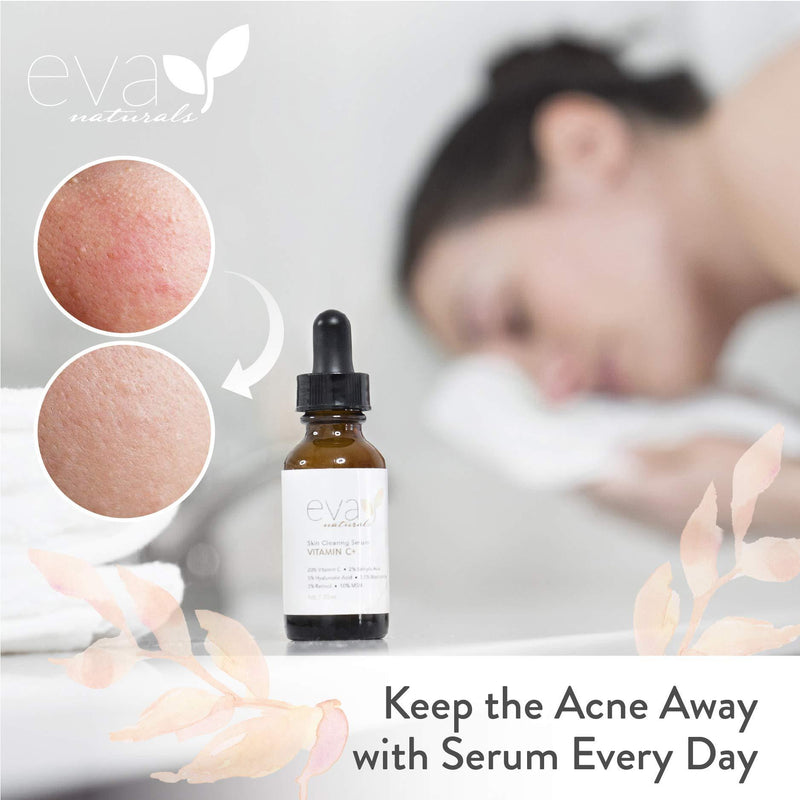 Eva Naturals Vitamin C Serum Plus 2% Retinol, 3.5% Niacinamide, 5% Hyaluronic Acid, 2% Salicylic Acid, 10% MSM, 20% Vitamin C - Skin Clearing Serum - Anti-Aging Skin Repair, Face Serum (1 oz) 1 Ounce (Pack of 1)