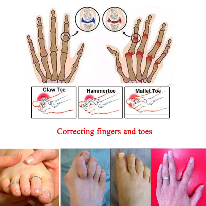 6 Pcs Broken Toe Separator Wrap Hammer Toe, Toe Straightener, Cushioned Bandages Toe Splint Wraps Separator for Broken Injured Finger Hammer Toe