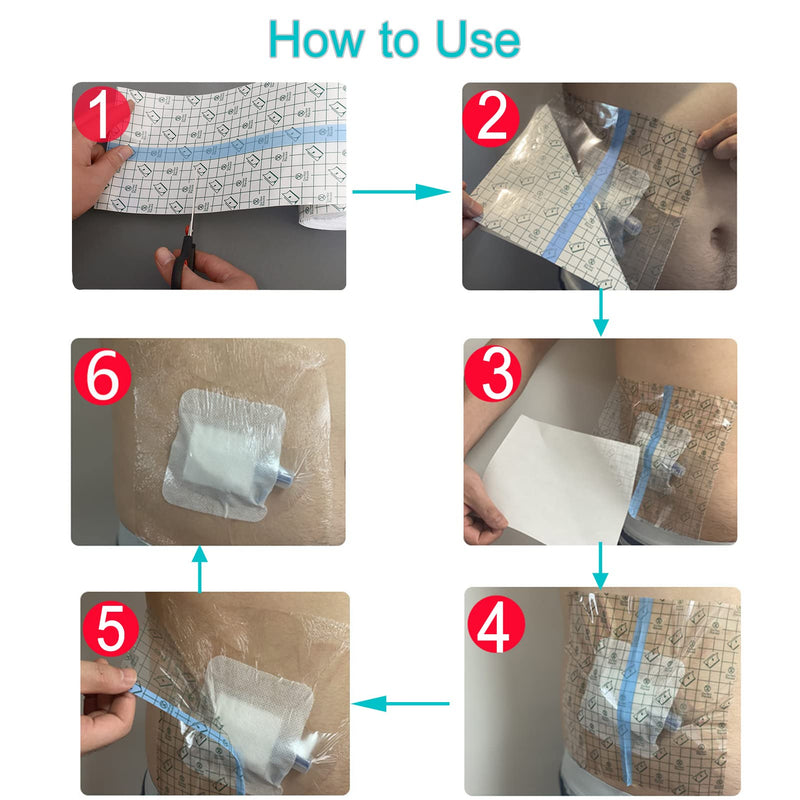 Waterproof PICC line Shower Cover Shield Protector Peritoneal Dialysis Accessories Large Coverage for Central Line PD Catheter Feeding G Peg Tube Chest Port Transfer Set Men Women (9"x 9",Pack of 25) (9"x 9",pack of 25)