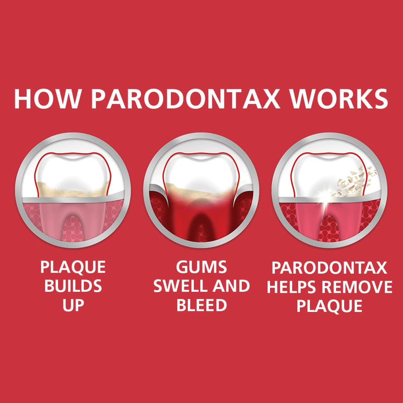 Parodontax Whitening Toothpaste for Bleeding Gums, Teeth Whitening and Gingivitis Treatment - 3.4 Ounces (Pack of 3)