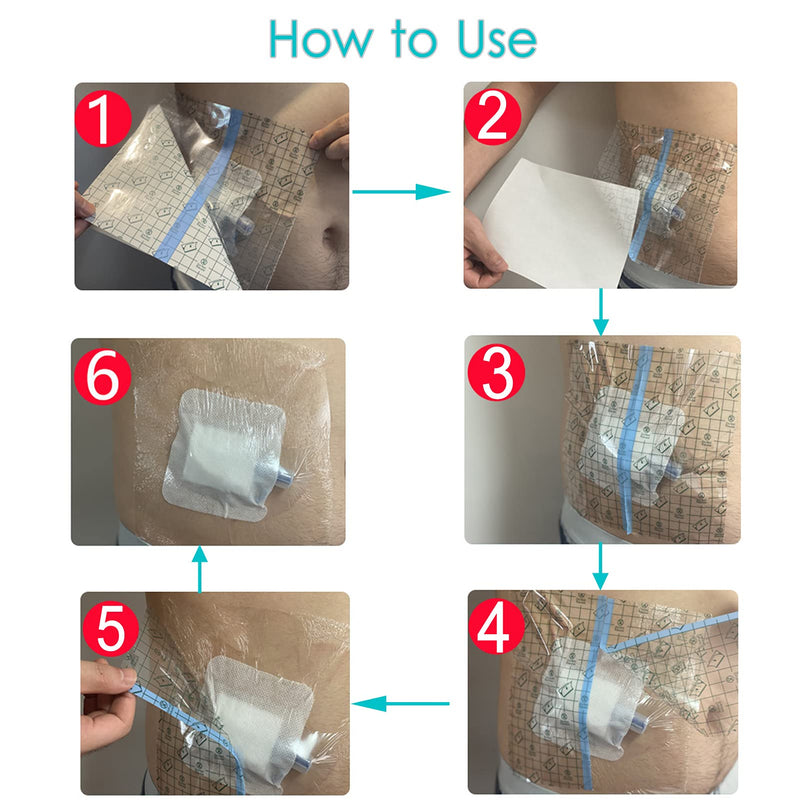 Peritoneal Dialysis Shower Protector Shields, Waterproof Dialysis Port Cover for PD Chest Catheter Peg Feeding Tube G-Tube Picc Line Post Surgery Patient Bathing 7.9"x7.9"(Pack of 25) 8x8 Inch (Pack of 25)