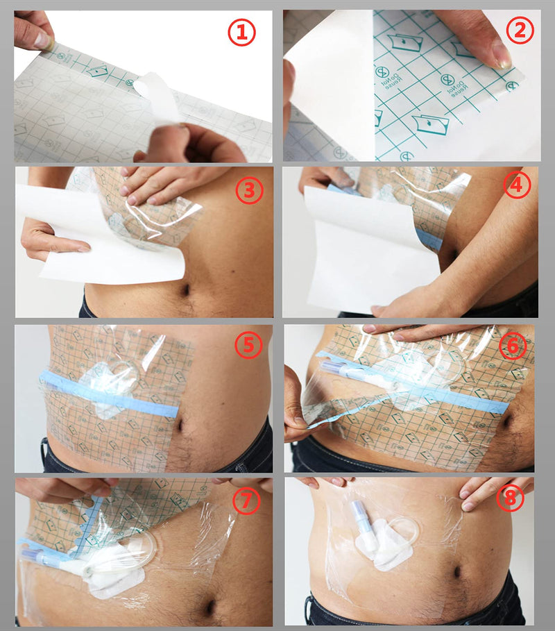 Mediss Peritoneal Dialysis Catheter Shower Cover - Transparent Film Wound Dressing Shields Barrier,8 inches x8 inches , 50pcs