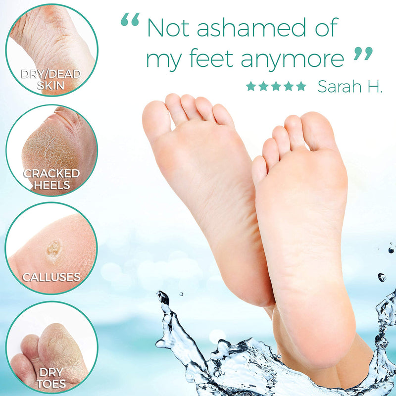 Foot Peel Mask - 2 Pack - For Cracked Heels, Dead Skin & Calluses - Make Your Feet Baby Soft & Get a Smooth Skin, Removes & Repairs Rough Heels, Dry Toe Skin - Exfoliating Peeling Natural Treatment Pack of 2