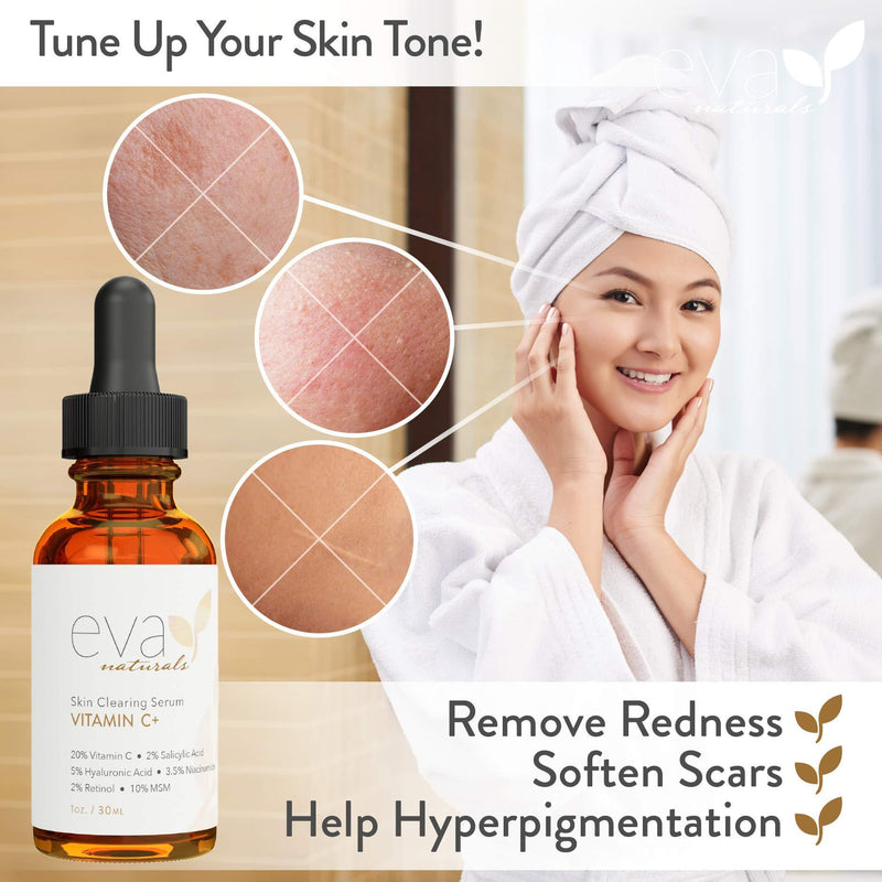 Eva Naturals Vitamin C Serum Plus 2% Retinol, 3.5% Niacinamide, 5% Hyaluronic Acid, 2% Salicylic Acid, 10% MSM, 20% Vitamin C - Skin Clearing Serum - Anti-Aging Skin Repair, Face Serum (1 oz) 1 Ounce (Pack of 1)
