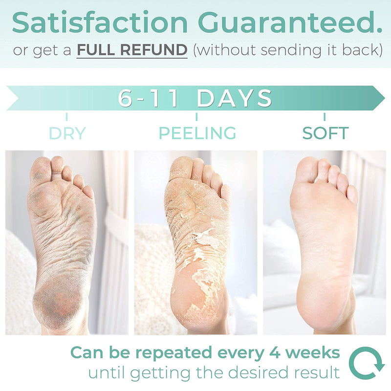 Foot Peel Mask - 2 Pack - For Cracked Heels, Dead Skin & Calluses - Make Your Feet Baby Soft & Get a Smooth Skin, Removes & Repairs Rough Heels, Dry Toe Skin - Exfoliating Peeling Natural Treatment Pack of 2
