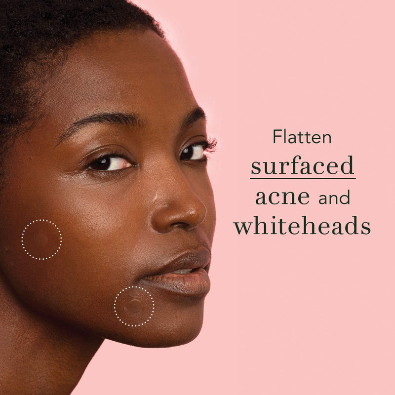 Rael Acne Pimple Healing Patch - Absorbing Cover, Invisible, Blemish Spot, Hydrocolloid, Skin Treatment, Facial Stickers, Two Sizes 10mm & 12mm (96 Count)