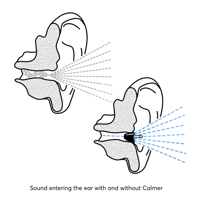 Flare Audio® Calmer® Night Black – in Ear Device to Gently Soothe Sound sensitivities - Reduce Stress in The Evening and Whilst Sleeping